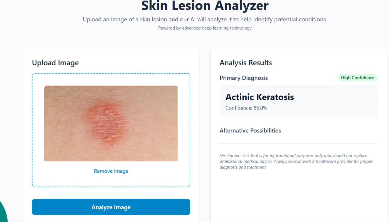 LesionCare